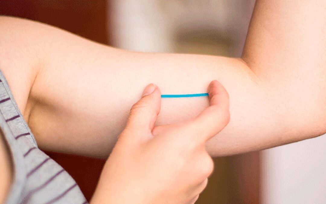 Continuidad y satisfacción en la anticoncepción con implante subdérmico a los 6 y 12 meses de su implementación en el posparto inmediato