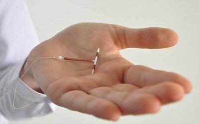 Estudio “COMSE” Maternidad segura como resultado del uso de métodos de anticoncepción de alta adherencia y efectividad en el posparto inmediato