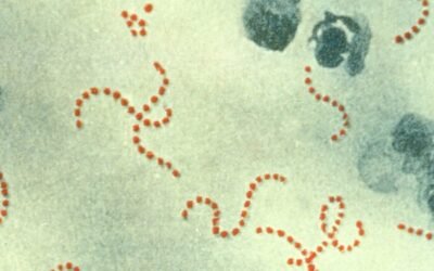 The International Infections in Pregnancy Study: group B streptococcal colonization in pregnant women