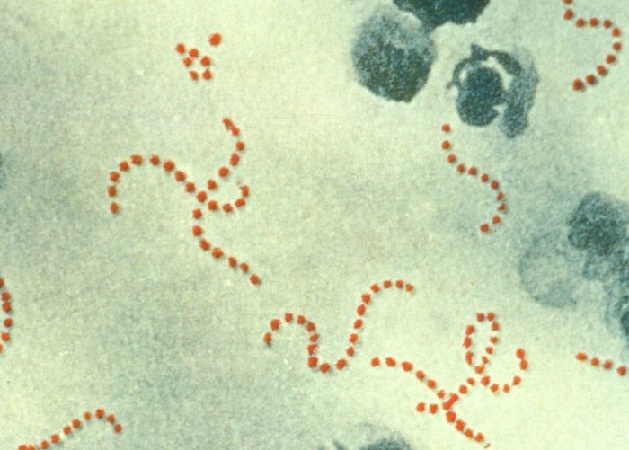 The International Infections in Pregnancy Study: group B streptococcal colonization in pregnant women